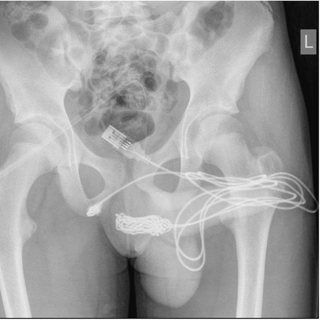 1-s2.0-S2214442021002904-gr1_lrg