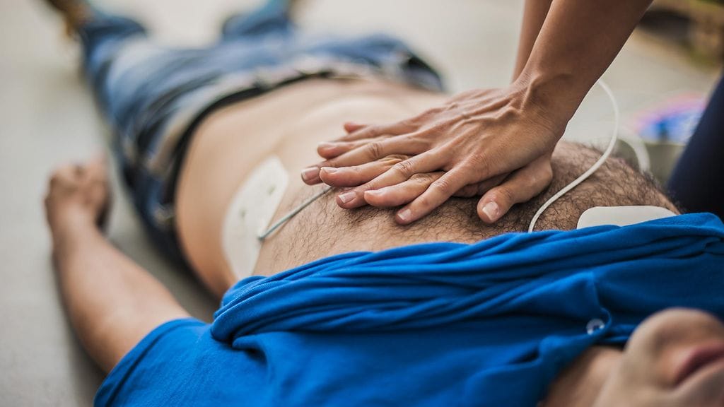 Jos sydänkohtauksen saanut menee elottomaksi, tulee aloittaa painelu-puhalluselvytys. Kuvituskuva.