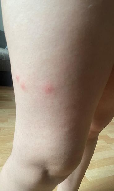 luteiden purema monica