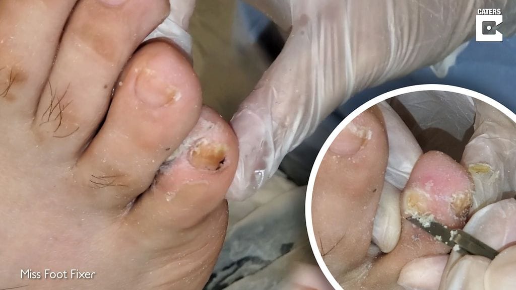 Marion hoitaa jalkoja.