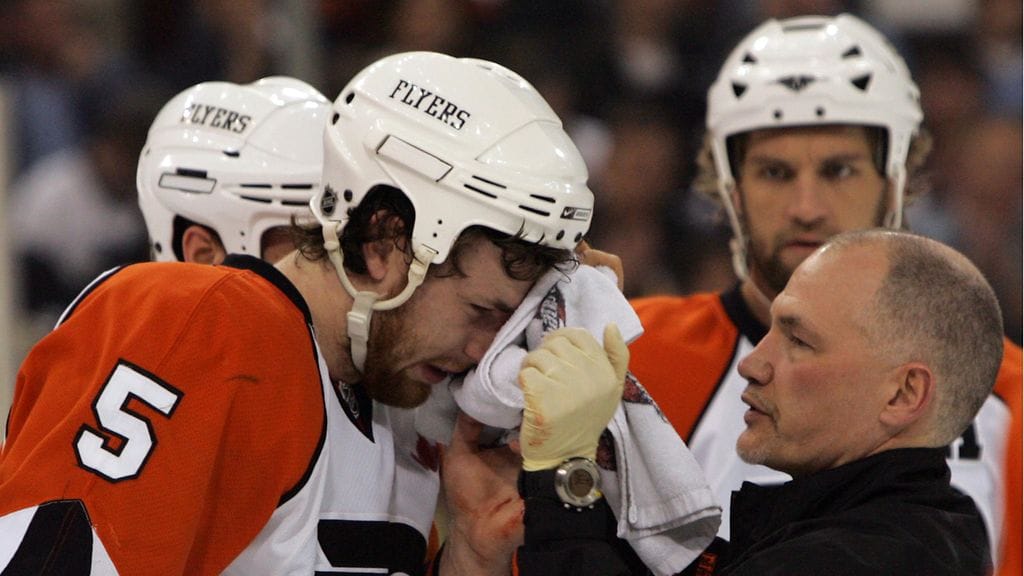 Jim McCrossin paikkasi Braydon Coburnin kasvoja vuoden 2008 pudotuspeleissä Pittsburgh Penguinsia vastaan.