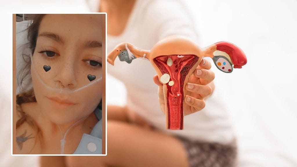 Australialaisnaisen vatsaongelmien taustalta löytyi astetta ikävämpi yllätys.