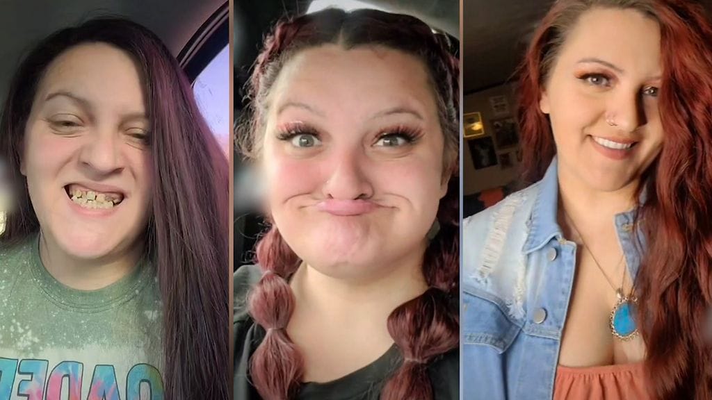 Dakilalla on tekohampaat.