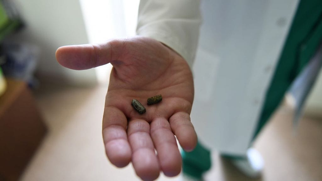 Harkovassa uhrin kehosta poistettuja metallipaloja.