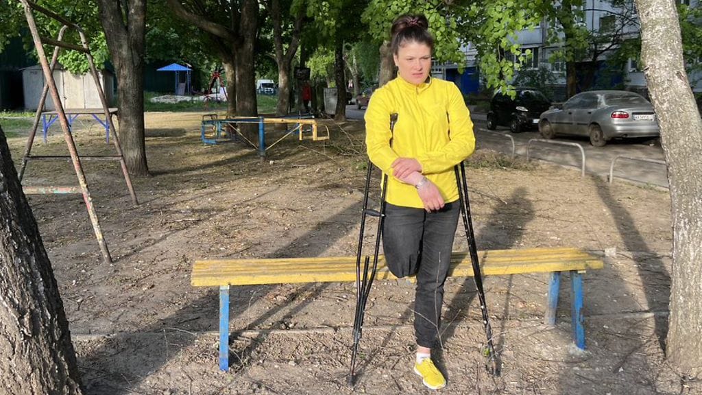 Jalkansa Ukrainassa menettänyt Veronica Tšerevytško.