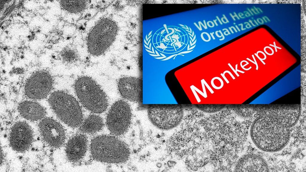 WHO harkitsee myös taudin nimeämistä uudelleen.