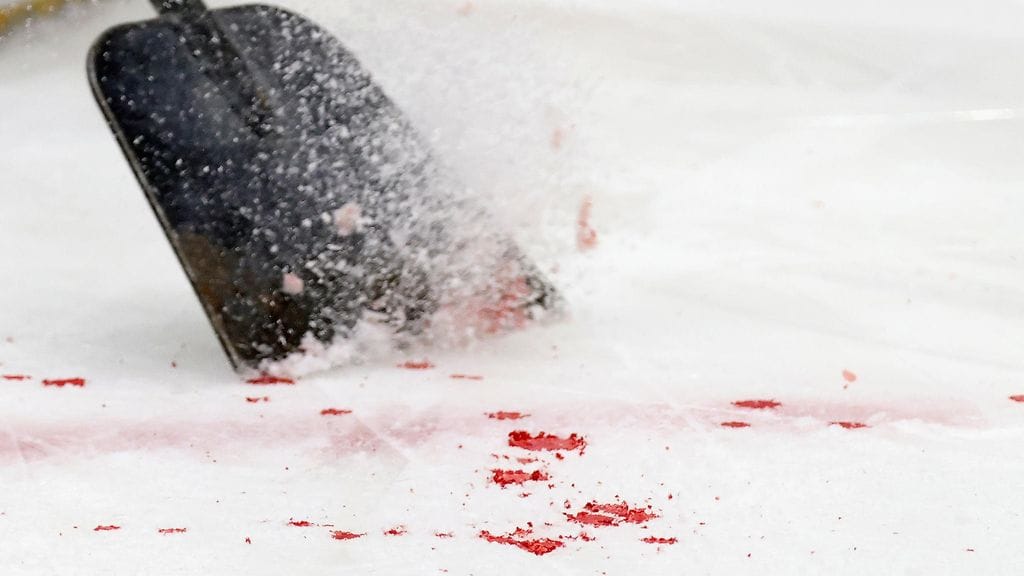 Andersson kertoo kärsineensä muun muassa univaikeuksista. Kuvituskuva.