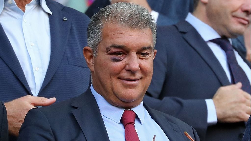 Joan Laportan kasvoja koristi mojova musta silmä.