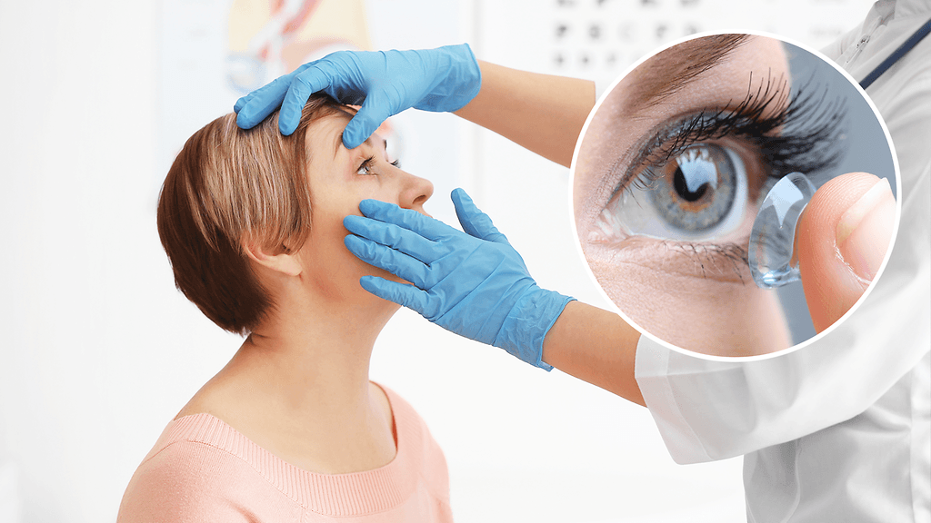 Amerikkalainen silmälääkäri löysi potilaan silmästä 23 piilolinssiä.