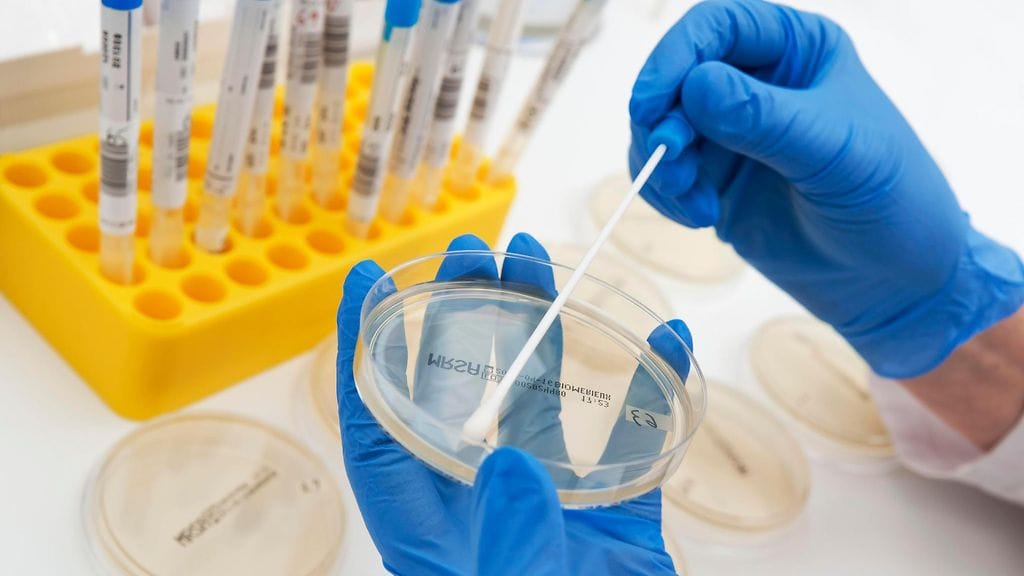 Satoja altistunut listerialle tukholmalaisravintolassa. Kuvituskuva