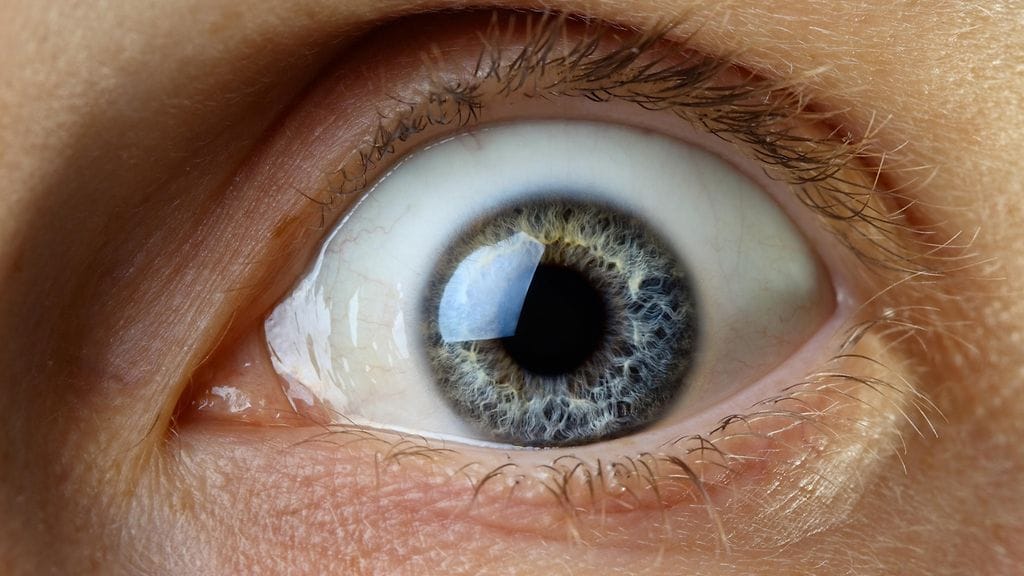 Silmämuniaan pullauttamalla voi päästä ennätystenkirjaan. Brasilialaismiehen ennätystä voi kuitenkin olla hankala voittaa. Kuvituskuva.