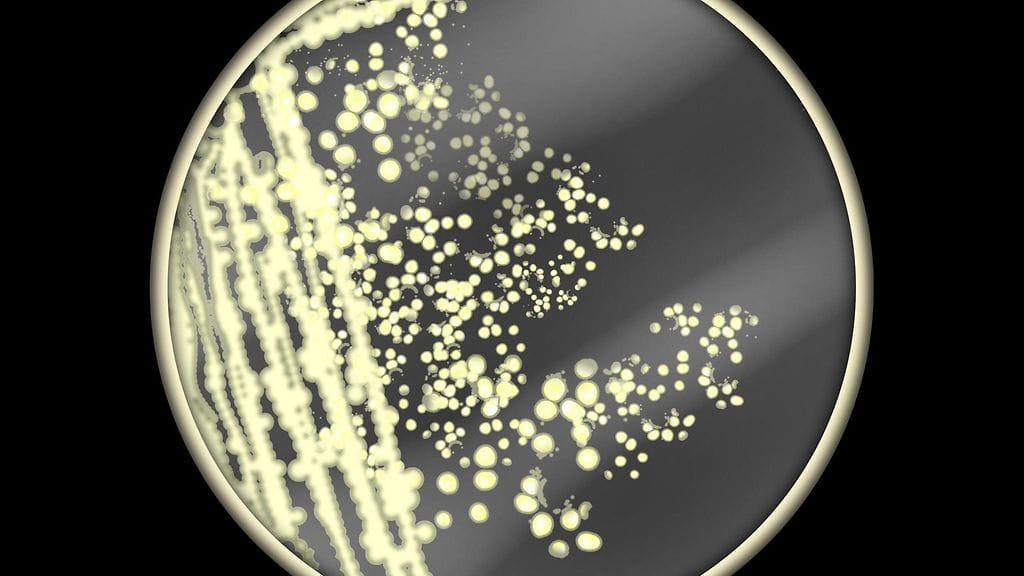 Candida auris -hiivasieni mikroskooppikuvassa.