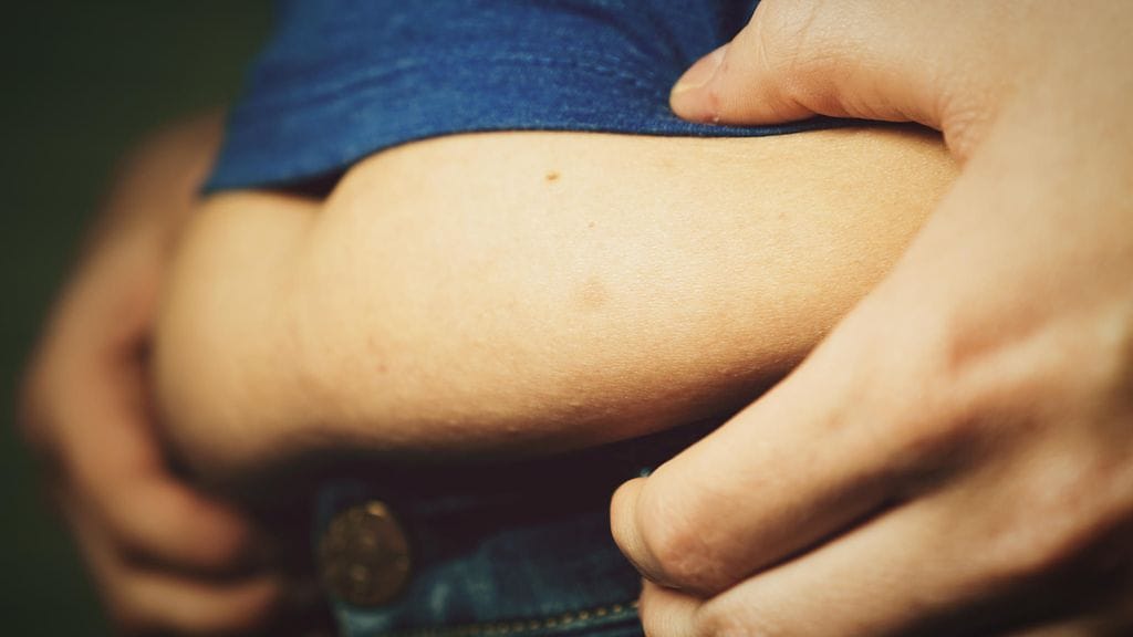 vyötärölihavuus, viskeraalinen rasva