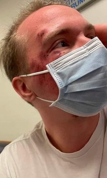 Jerry Riikonen onnettomuuden jälkeen