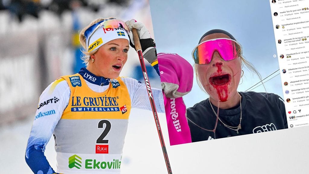 Frida Karlssonille sattui onnettomuus kesken hiihtolenkin.