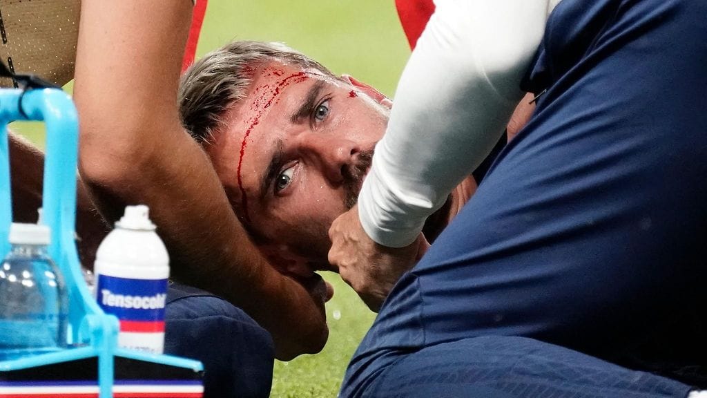 Ranskan tähti Antoine Griezmann sai vastustajalta karatepotkun päähän, kaatui verisenä nurmelle – "Ei mitään järkeä!"