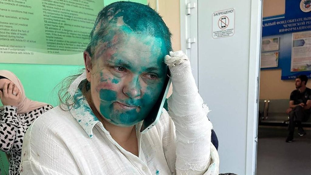 Jelena Milashina sairaalassa Tshetshenian pääkaupungissa Groznyissa 4. heinäkuuta julkaistussa kuvassa. AFP PHOTO / The Crew Against Torture / Sergei Babinets