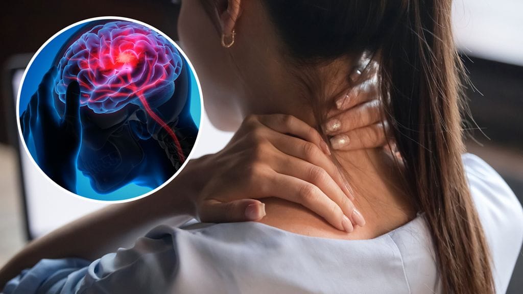 Migreeni voi oireilla niska-hartiaseudun jumiutumisena.