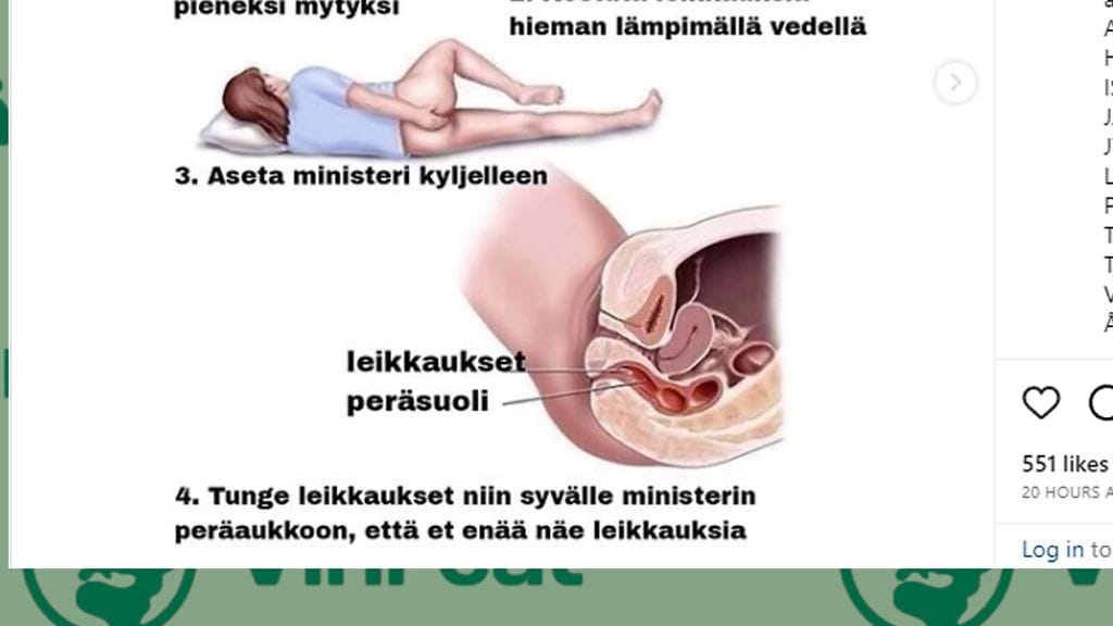 Leikkauksista pillastunut vihreä nuoriso ohjeistaa työntämään leikkaukset sinne, minne päivä ei paista.