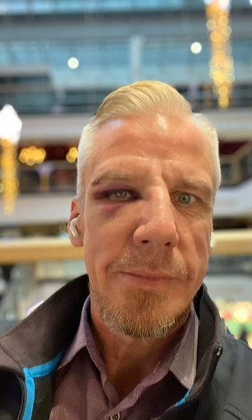 Roy murtunun nenä
