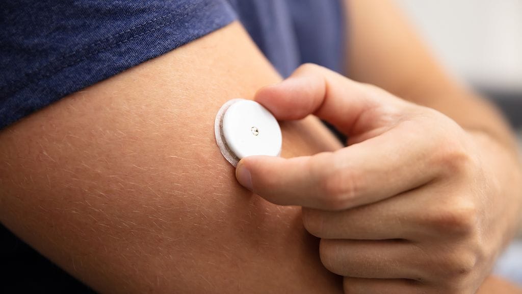 Verensokeri sensori mittaus diabetes