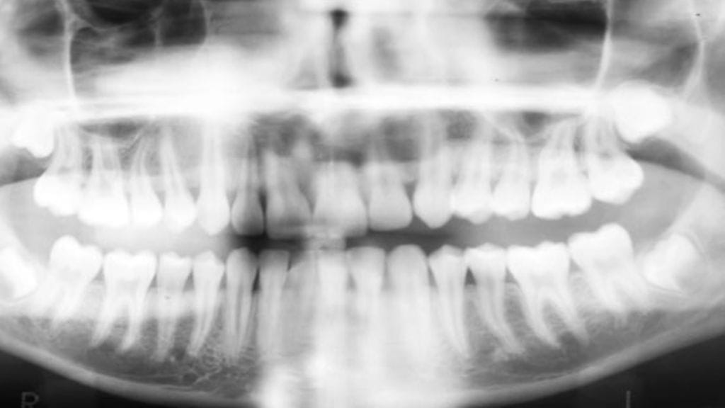 Suomalaisten hampaista kertyy kattavasti tietoa. Kuvituskuva.