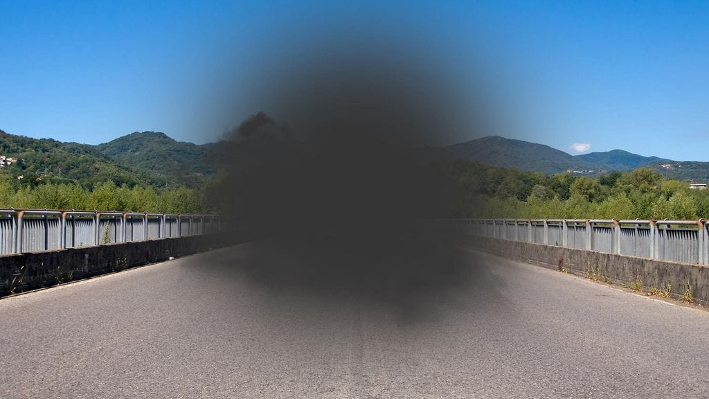 silmäpohjan rappeuma