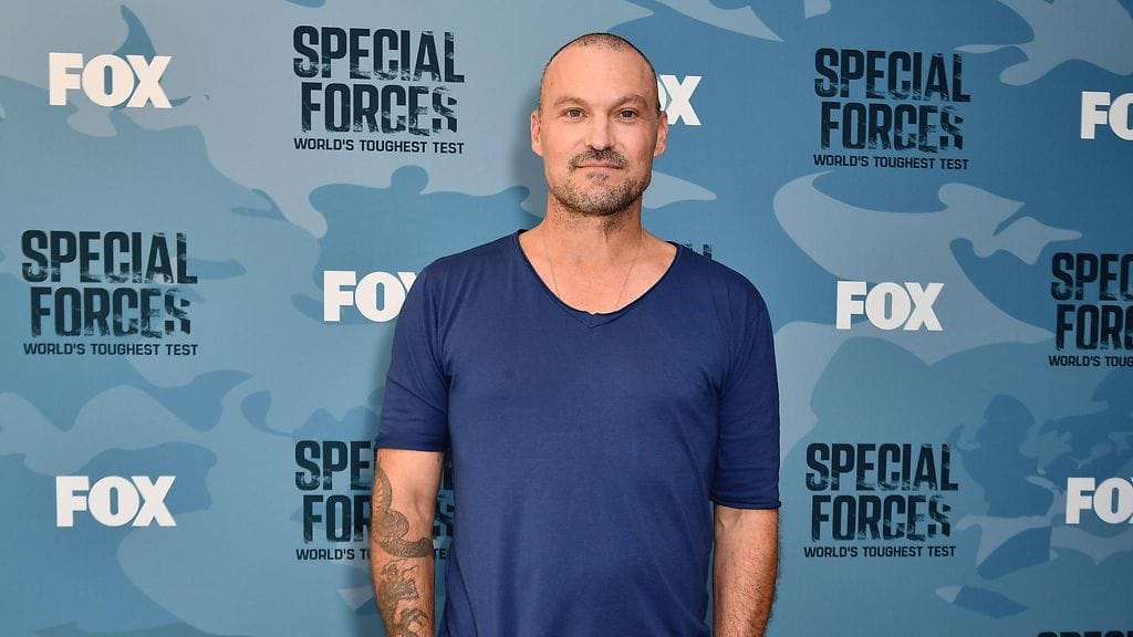 Brian Austin Greenille tehtiin vasektomia, eli miesten sterilisaatio, vuonna 2022.