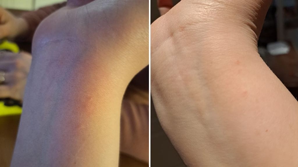 syyhyihottuma ranteessa