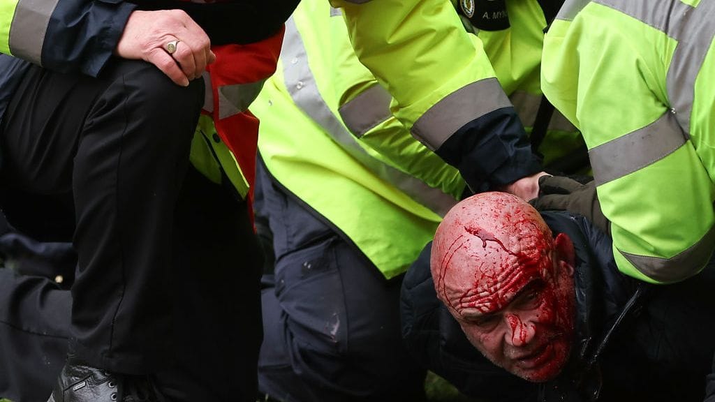 Black Country Derbyssä tehtiin useita pidätyksiä.