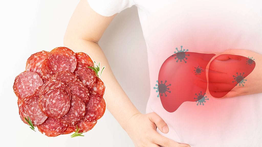 Hepatiitti E -tartunnan saaneista moni kertoi syöneensä meetvurstia sai salamia. Yhteys vaatii kuitenkin lisäselvityksiä.