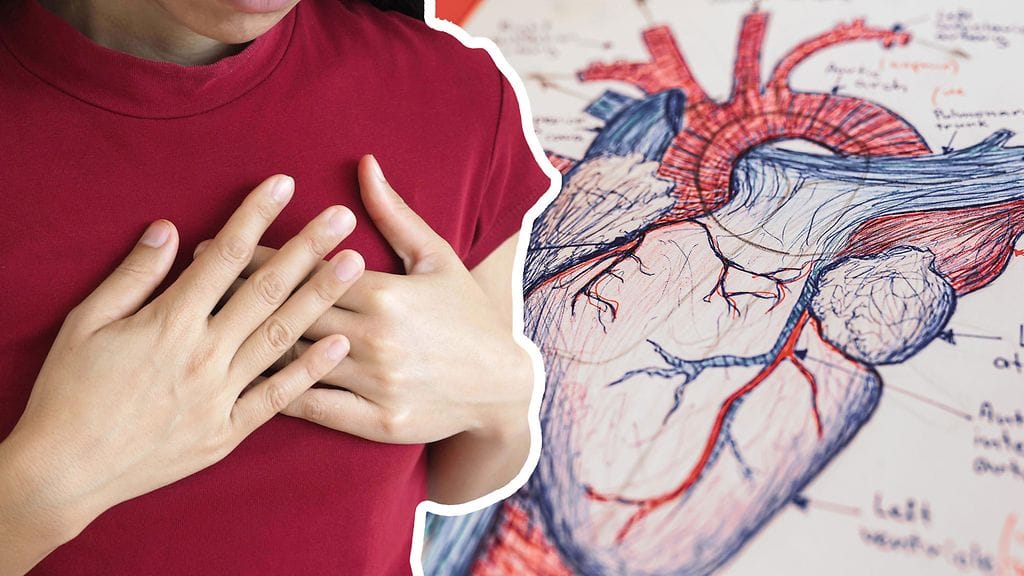 Eteisvärinän aikana sydämen syke on epäsäännöllinen, ja yleensä tuntuu nopeammalta kuin tavallisesti.