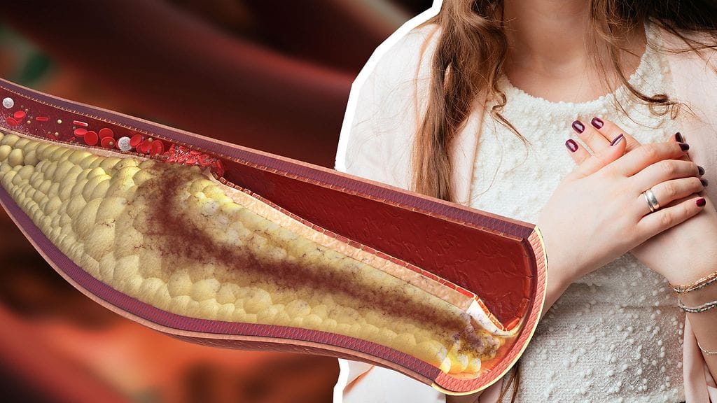 Sydänkohtaus voikin olla infektiosairaus. Kuvituskuva.