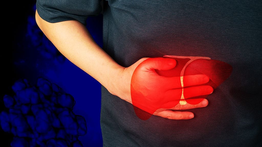 Hepatiitti E on viruksen aiheuttama maksatulehdus.