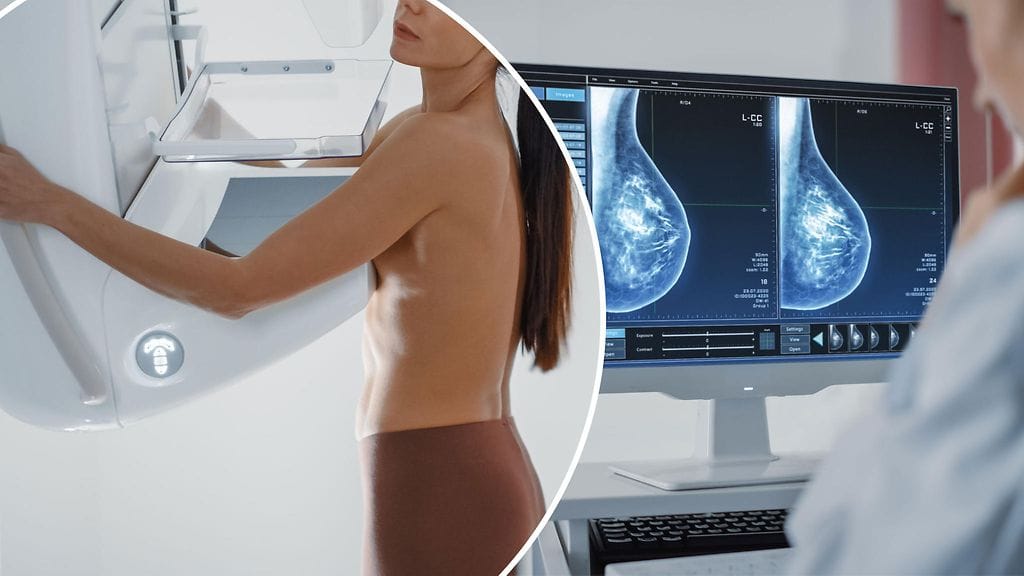 Ensimmäisen mammografiaseulonnan väliin jättäneiden riski menehtyä syöpään voi nousta.
