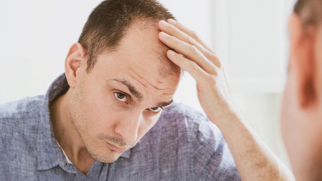 Hiustenlähdön hoitoon tarkoitettua lääkettä tilattaessa ulkomailta pitää olla yhtä tarkkana kuin muita lääkkeitä tilattaessa. Kuvituskuva.