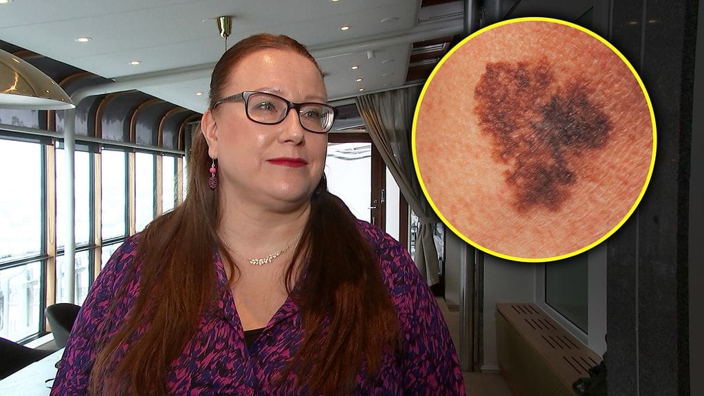 Melanooma muutti Sirpan elämän