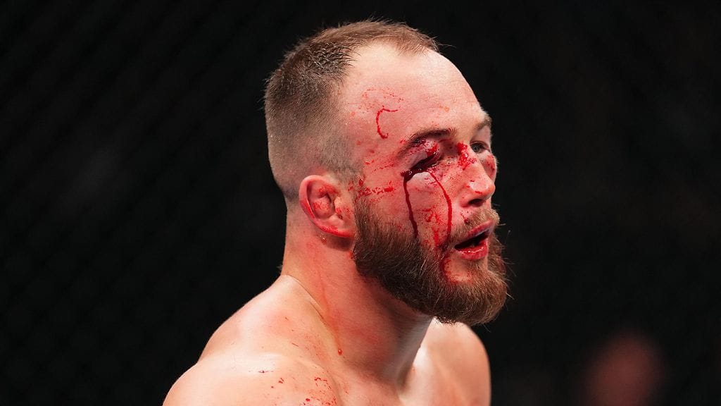 Mateusz Rebecki oli hurjan näköisenä UFC-ottelun myötä.