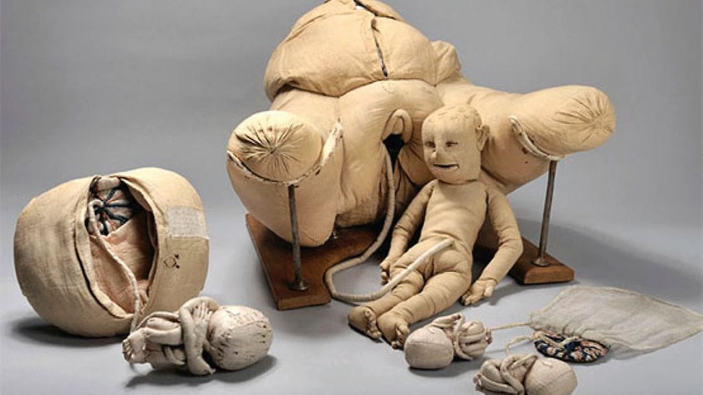 Ranskan kuninkaan Ludvig XV:n hovissa työskennellyt hovikätilö Angélique Marguerite Le Boursier du Coudray (1712–1789) kehitti kätilötiedon opetusta ja siihen liittyneitä havaintovälineitä. Kuvassa on hänen tähän tarkoitukseen kankaasta valmistamansa naisen synnyttimet, kohtu, istukka ja eri-ikäisiä sikiöitä. Vastaavia havaintovälineitä käytettiin myös Tukholmassa kätilöiden opetuksessa. kuva bruno maurey / musée flaubert et d’histoire de la médecine chu rouen.