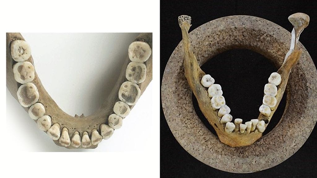 Leukojen vertaus kuva