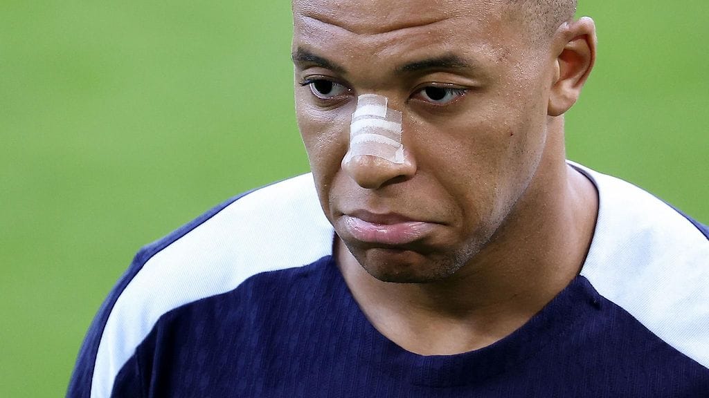 Kylian Mbappe loukkaantui Ranskan EM-avauksessa