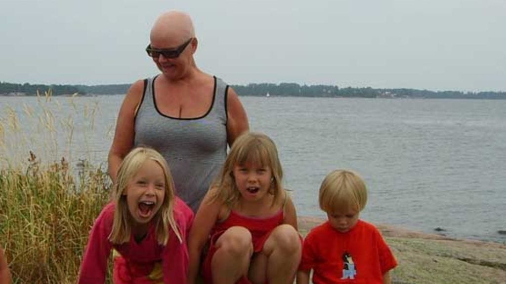 Alme on nykyään sinut alopecian kanssa.