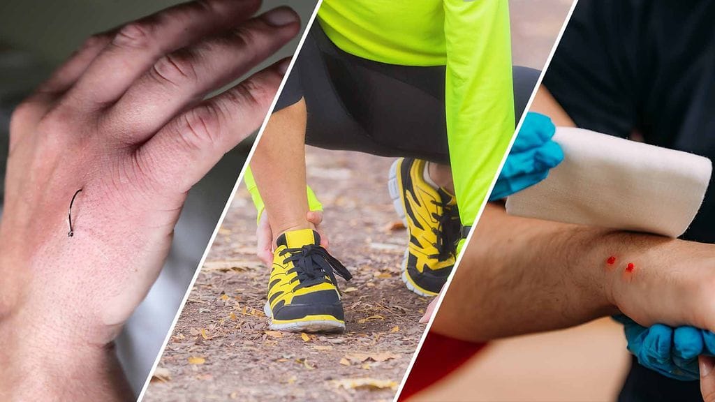 Ihoon uppoutuneet ongen- ja uistimenkoukut, nyrjähdykset ja venähdykset sekä käärmeiden ja punkkien puremat työllistävät päivystyksiä kesäisin.