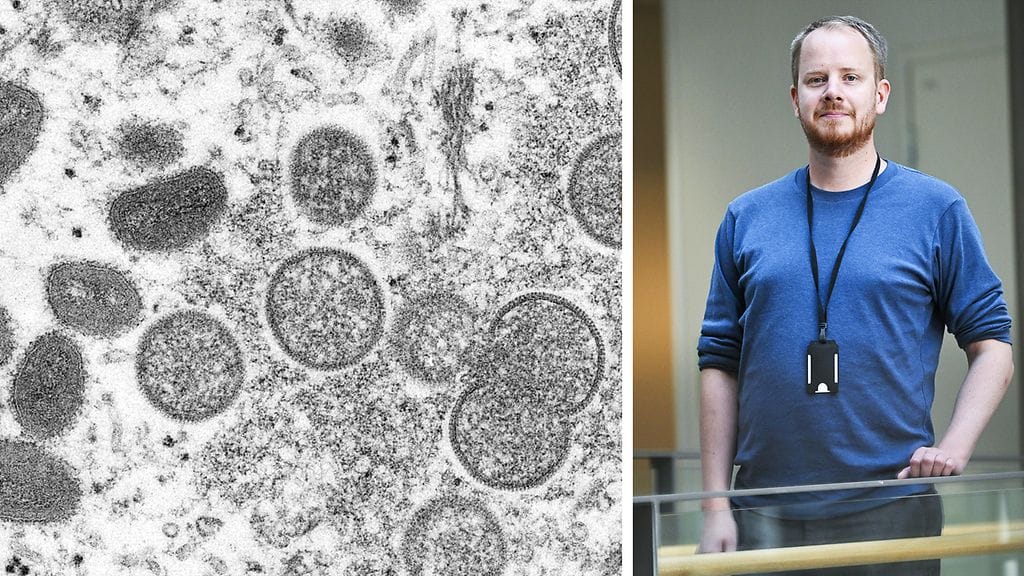 "En vertaisi tilannetta koronaviruspandemiaan", ylilääkäri sanoo apinarokosta.