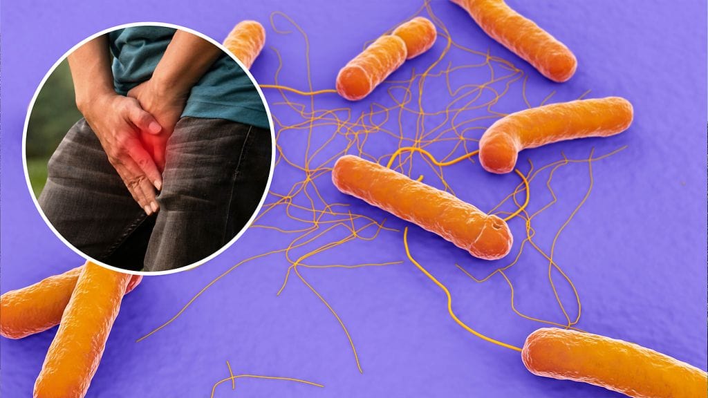 Miehen penisongelmien syyksi paljastui Bacillus cereus -bakteeri.