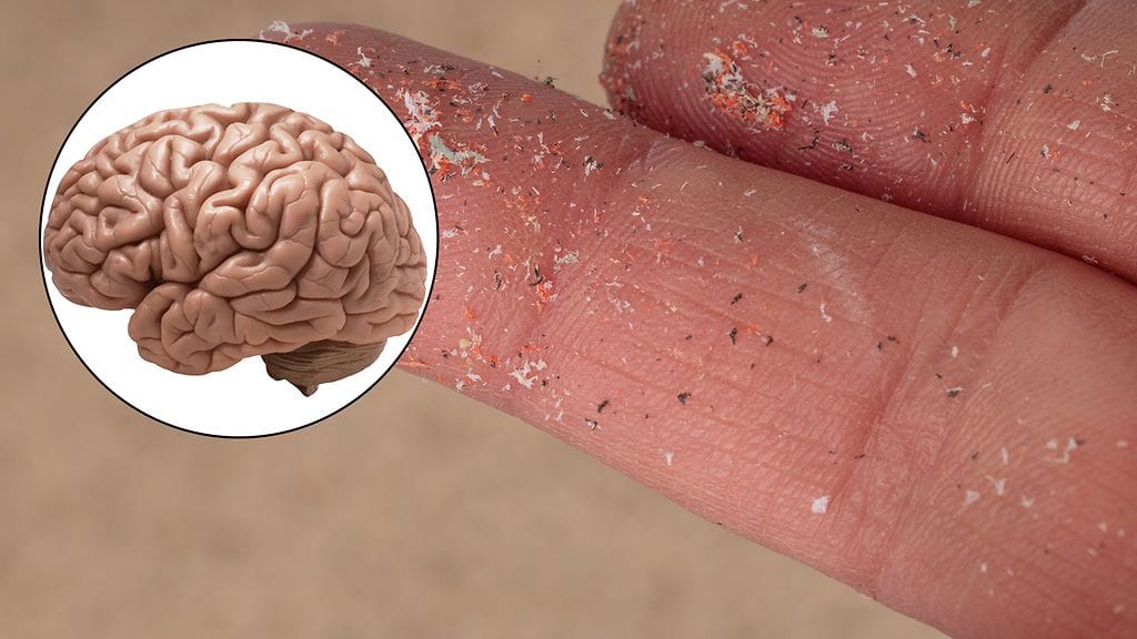 Tutkijoiden mukaan nanomuovit voivat läpäistä veri-aivoesteen. Nanomuovit ovat mikromuoviakin pienempää hiukkasta.