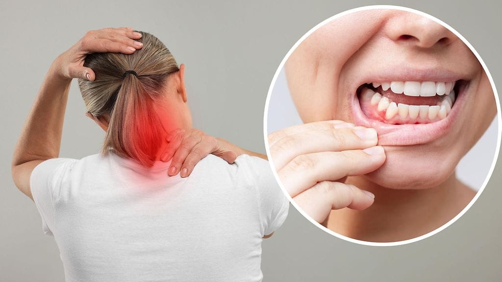 Suun sadoista bakteereista 13 yhdistettiin 30 prosenttia kohonneeseen syöpäriskiin.