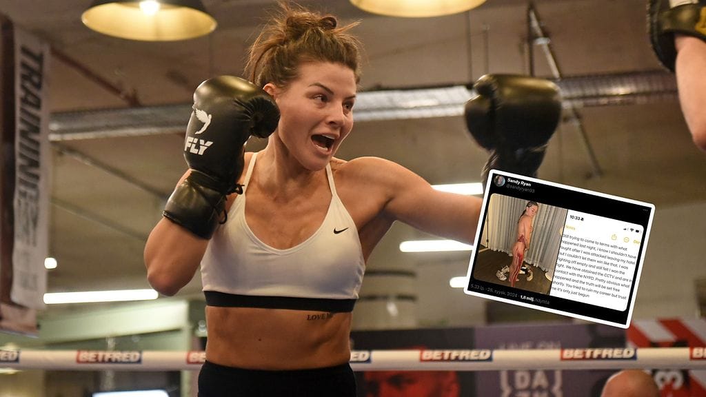 Sandy Ryan julkaisi itsestään alastonkuvan, jossa näkyivät värihyökkäyksen jäljet.