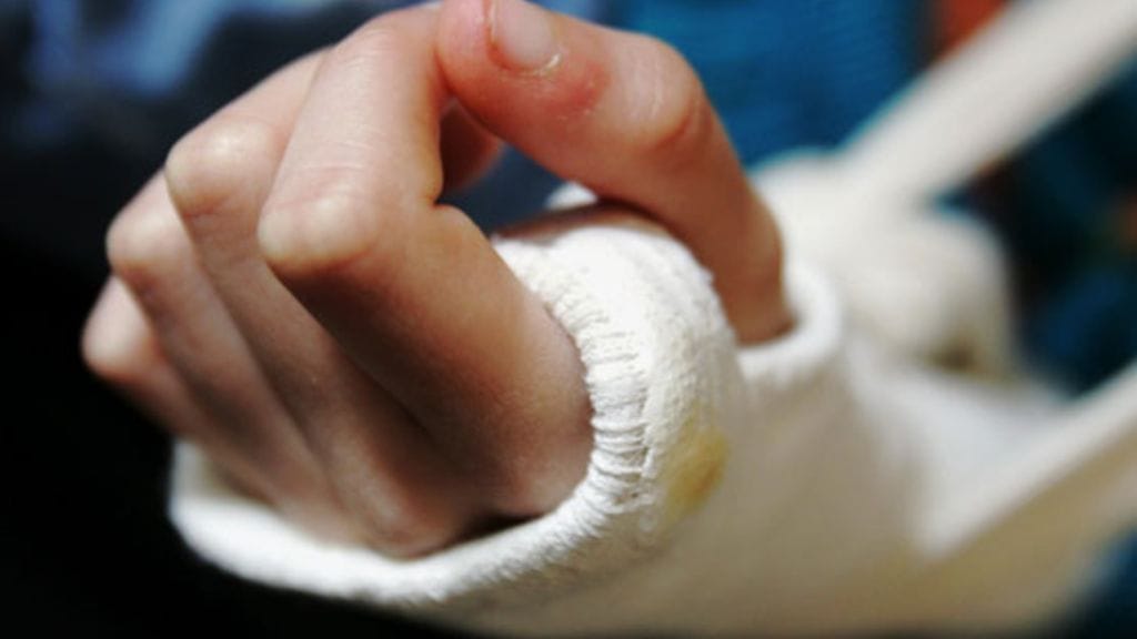 Rannemurtumat kuuluvat yleisimpiin korvattaviin potilasvahinkoihin. Kuvituskuva.