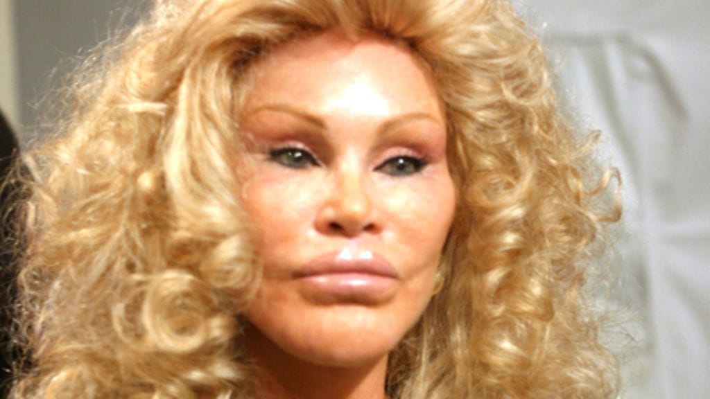 Jocelyn Wildenstein on tehnyt kauneusleikkauksia miljoonilla dollareilla.